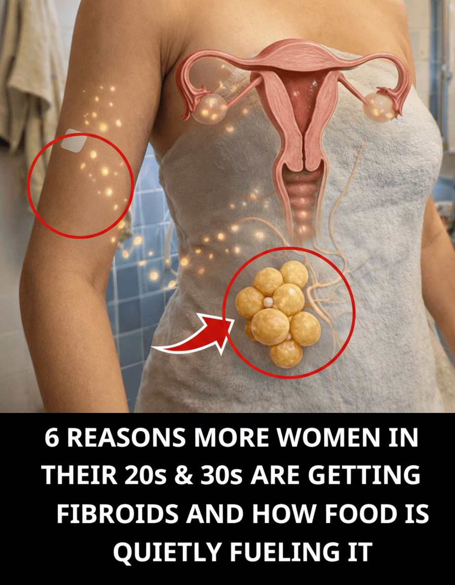 6 Reasons Why Uterine Fibroids Are Becoming More Common in Women in Their 20s and 30s — And the Surprising Role of Everyday Foods